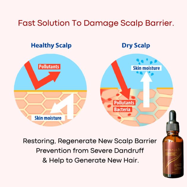 Hair Tonic Dry Scalp Treatment 30ml - Image 3